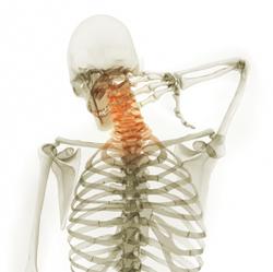 Neck injury