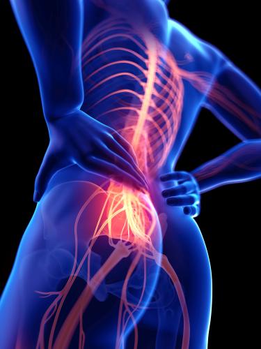 nerve damage